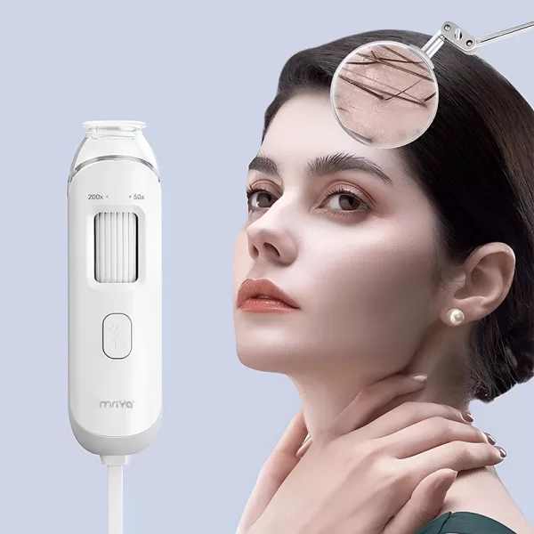 scalp camera, hair camera,